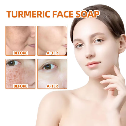 West&Month Turmeric Facial Soap for Gentle Cleansing