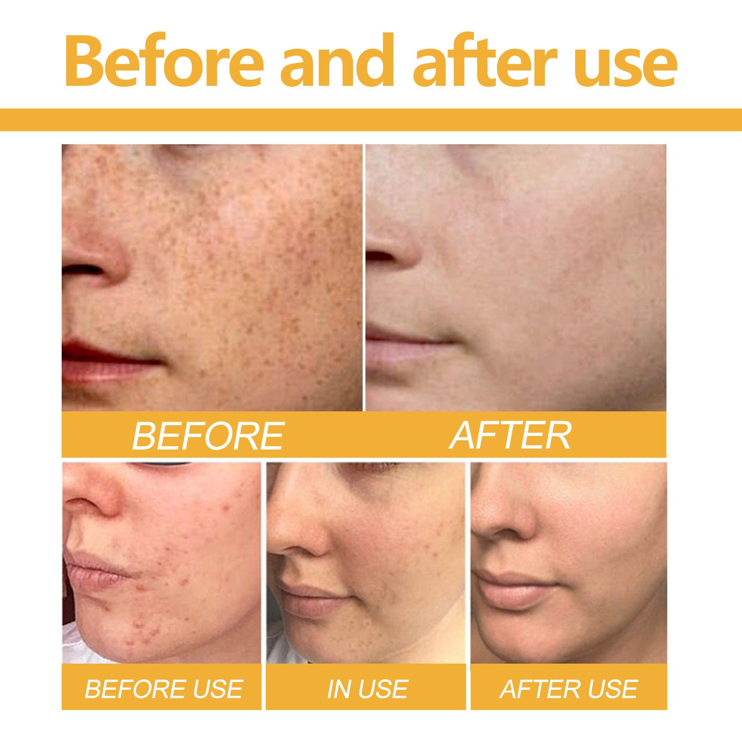 Kojic Acid Soap
