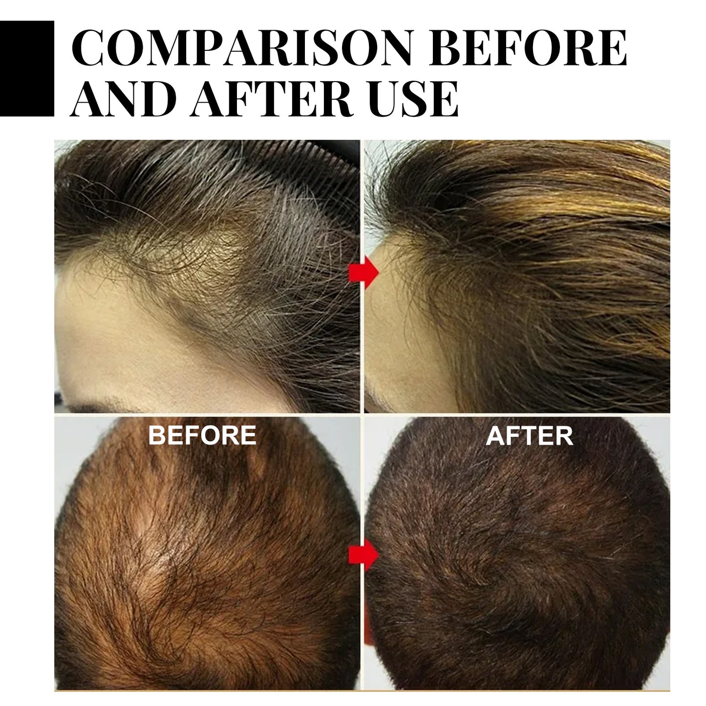 Jaysuing Batana Series Nourishing Hair Care Treatment
