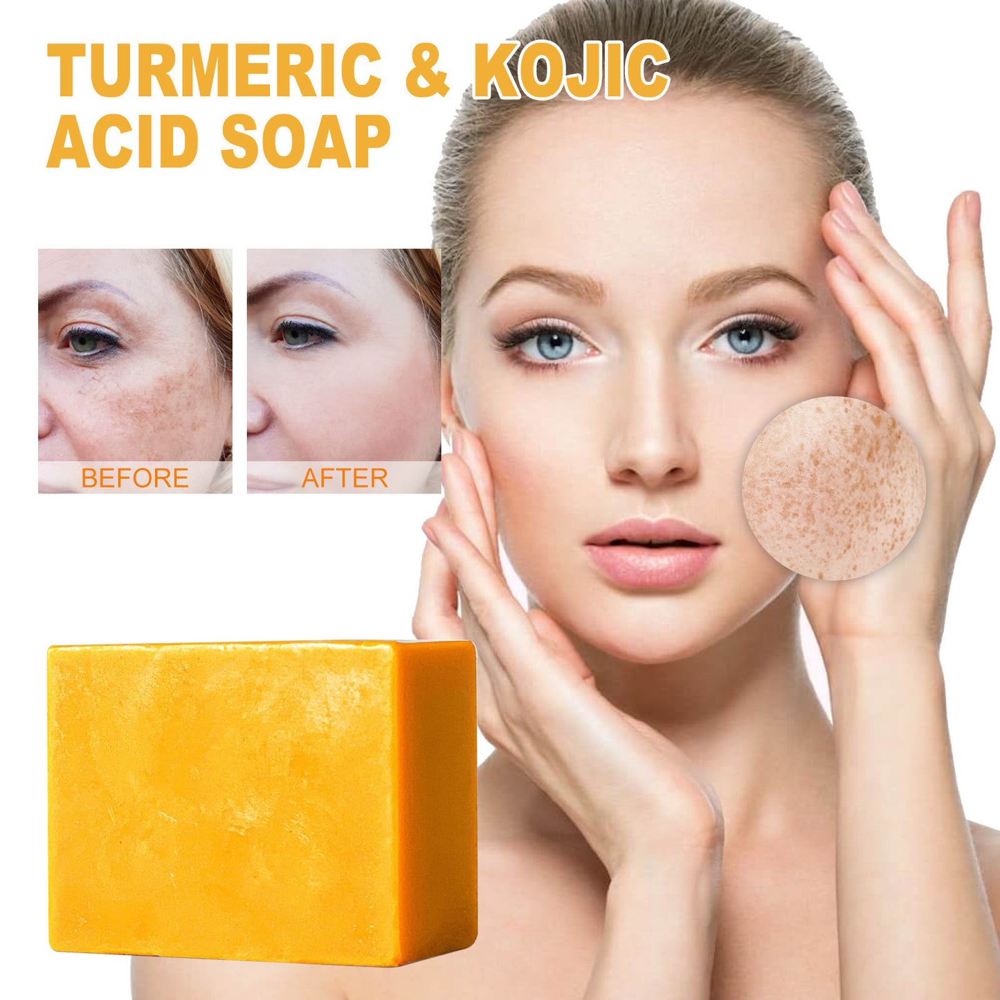 Kojic Acid Soap